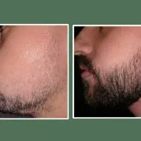 برای ریشت این شربت جادو می‌کنه