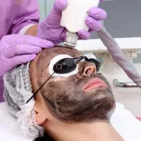 لیزر کربن سفید کننده و ضد لک و ریمو تتو تخفیف ۵۰٪