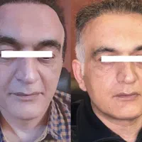 جشنواره اندولیفت تخصصی صورت وگردن|خدمات آرایشگری و زیبایی|تهران, جماران (نیاوران)|دیوار