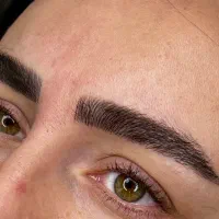 مدل برای فیبروز و میکروبلیدینگ