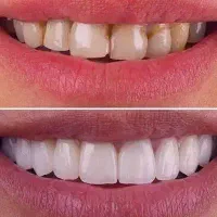 درمانگاه دندانپزشکی خاورمیانه/طرف قراردادبابیمه ها|خدمات زیبایی و سلامت|شیراز, عفیفآباد|دیوار