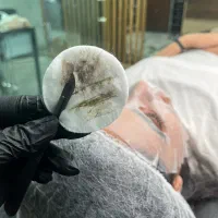 خدمات درماپلینینگ