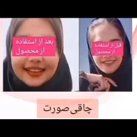 عسل چاقی پوما تضمینی حتی در دوران شیردهی|آرایشی، بهداشتی، درمانی|اشنویه, |دیوار