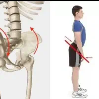 آزادسازی دردسیاتیک،ماساژعضلات،اصلاح لگن،رفع درد|خدمات آرایشگری و زیبایی|قم, سالاریه|دیوار