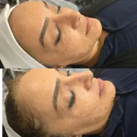 پاکسازی پوست/فشیال تخصصی|خدمات آرایشگری و زیبایی|شیراز, شهرک فرزانگان|دیوار