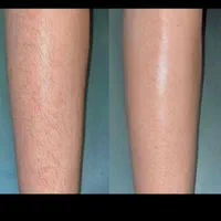 خدمات اپلاسیون