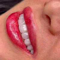 کامپوزیت فکی ۶ تومان/لمینیت / بیلیچینگ/روکش|خدمات آرایشگری و زیبایی|تهران, اوقاف|دیوار