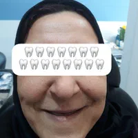 دندانسازی رستمی|خدمات آرایشگری و زیبایی|زنجان, |دیوار