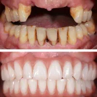 دندان پزشکی|خدمات آرایشگری و زیبایی|کرمانشاه, |دیوار