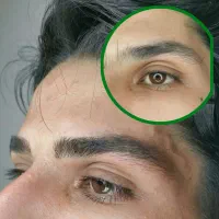 فیبروز ابرو آقایان/ میکروبلیدینگ آقایان/ اسکالپ سر|خدمات آرایشگری و زیبایی|تبریز, |دیوار