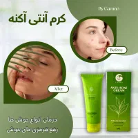 ضد اکنه|آرایشی، بهداشتی، درمانی|شیراز, آبیاری|دیوار