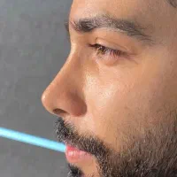 تخفیف عمل بینی فقط۳۹ لیپو ابدو مامو لیفت صورت|خدمات زیبایی و سلامت|تهران, میدان ولیعصر|دیوار