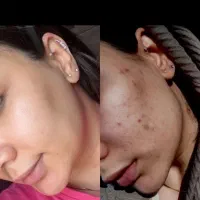 پوستت مثل آینه میشه