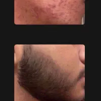 ریشاتو مثل چمن کن