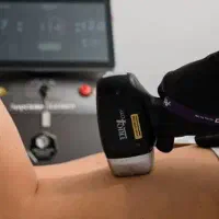 استخدام اپراتور لیزر با دستگاه