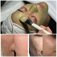 اجاره لاین در کلینیک زیبایی زیر نظر پزشک