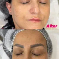مرکز فشیال تخصصی بانوان در کلینیک پوست مو فردیس|خدمات آرایشگری و زیبایی|فردیس, فردیس|دیوار
