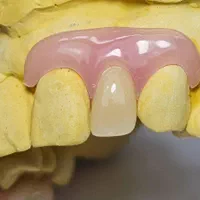 ساخت دندان مصنوعی اقساط با چک صیادی|خدمات آرایشگری و زیبایی|پردیس, فاز ۸|دیوار