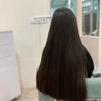 موخوره گیری تخصصی