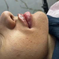 جشنواره ژل و بوتاکس|خدمات آرایشگری و زیبایی|شهرکرد, |دیوار