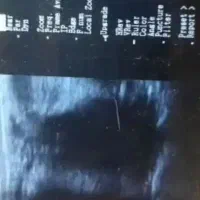 دستگاه سونوی دام