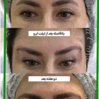 جشنواره ژل و بوتاکس