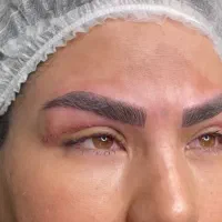 میکروبلیدینگ ابرو فیبروز شیدینگ