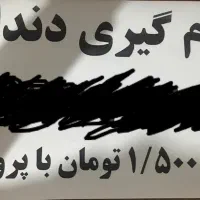 جرم گیری دندون