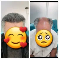 موهاتو قسطی بکار