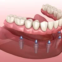 کلینیک تخصصی، دیجیتالی ایمپلنت و کاشت دندان حـامـی|خدمات آرایشگری و زیبایی|شیراز, ملاصدرا|دیوار