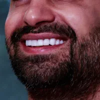 کامپوزیت دندان|خدمات آرایشگری و زیبایی|پرند, فاز ۶|دیوار