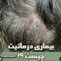 درمان تخصصی ریزش مو و رفع کم پشتی مو|خدمات آرایشگری و زیبایی|قم, صدوق|دیوار