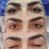 ژل ،بوتاکس،جراحی،زنان