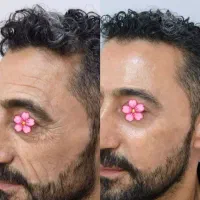 کرم ضد لک و جوانساز