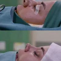 لیپوماتیک ، ابدو ،عمل بینی و..