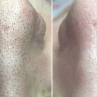 خدمات فشیال و پاکسازی پوست و همه خدمات آرایشگری