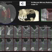 خدمات دندان پزشکی با قیمت  و شرایط عالی