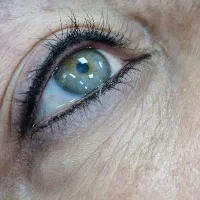 مدل رایگان جهت عکاسی فیبروز میکرو شیدینگ خط چشم|خدمات آرایشگری و زیبایی|تهران, جیحون|دیوار