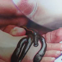 حجامت و زالوتراپی و طب سوزنی‌و پاکسازی بدن از سمو|خدمات آرایشگری و زیبایی|ارومیه, |دیوار