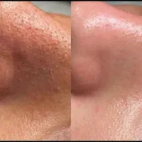 تخفیفات ۵۰٪ لیفت ابرو،پاکسازی صورت،بافت مو|خدمات آرایشگری و زیبایی|پاکدشت, پاکدشت (مامازند)|دیوار