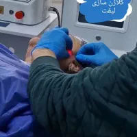 جشنواره بلفاروپلاستی ،اندولیف ،ساکشن غبغب