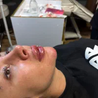 تزریق تخصصی ژل و بوتاکس  مشاوره رایگان|خدمات آرایشگری و زیبایی|اصفهان, خلیل آباد|دیوار