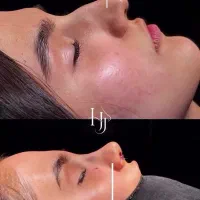 جراحی بینی توسط متخصص گوش و حلق بینی پرداخت اقساطی|خدمات زیبایی و سلامت|مشهد, احمدآباد|دیوار