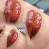 شیدینگ .فیبروز