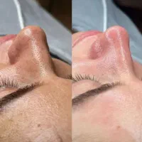 کاشت ناخن کاشت مژه فشیال تزریق ژل بوتاکس پرسینگ|خدمات آرایشگری و زیبایی|مشهد, رده|دیوار