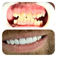 کلینیک تخصصی دندانپزشکی سیب (نرخ خدمات نیمه دولتی)|خدمات آرایشگری و زیبایی|تبریز, |دیوار