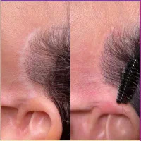 جوانساز پی آر پیprp صورت و ریزش مو و زخم و لک|خدمات آرایشگری و زیبایی|هشتگرد, شهرک ولیعصر (مصلی)|دیوار