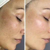 فیشال مدل|خدمات آرایشگری و زیبایی|اصفهان, سرچشمه|دیوار