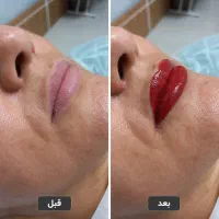 شیدینگ لب حرفه‌ای ، با قیمت باورنکردنی|خدمات زیبایی و سلامت|تهران, سجاد|دیوار
