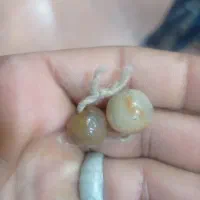 شوش دانیال|جواهرات|پرند, فاز ۰|دیوار